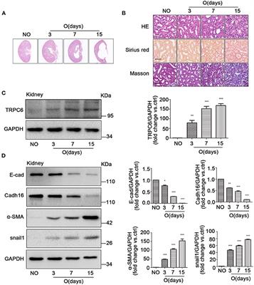 Transient Receptor Potential Channel 6 Knockout Ameliorates <mark class="highlighted">Kidney Fibrosis</mark> by Inhibition of Epithelial–Mesenchymal Transition